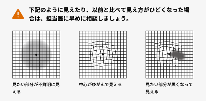 黄斑上膜 黄斑円孔 大宮いけだ眼科