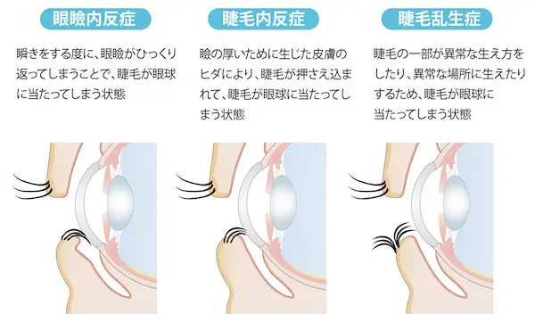 まつ毛 生える 販売 場所